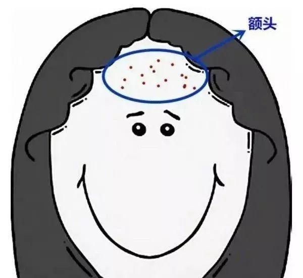 痘痘怎么去除有效果？从饮食到护肤都需要你掌握的知识关于痘痘有效去除的方法  第1张